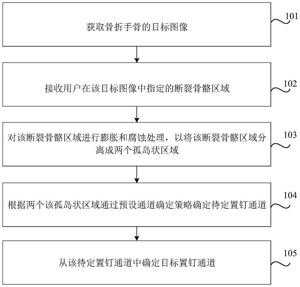 Intelligent planning method and device for hand bone fracture nail placement channel