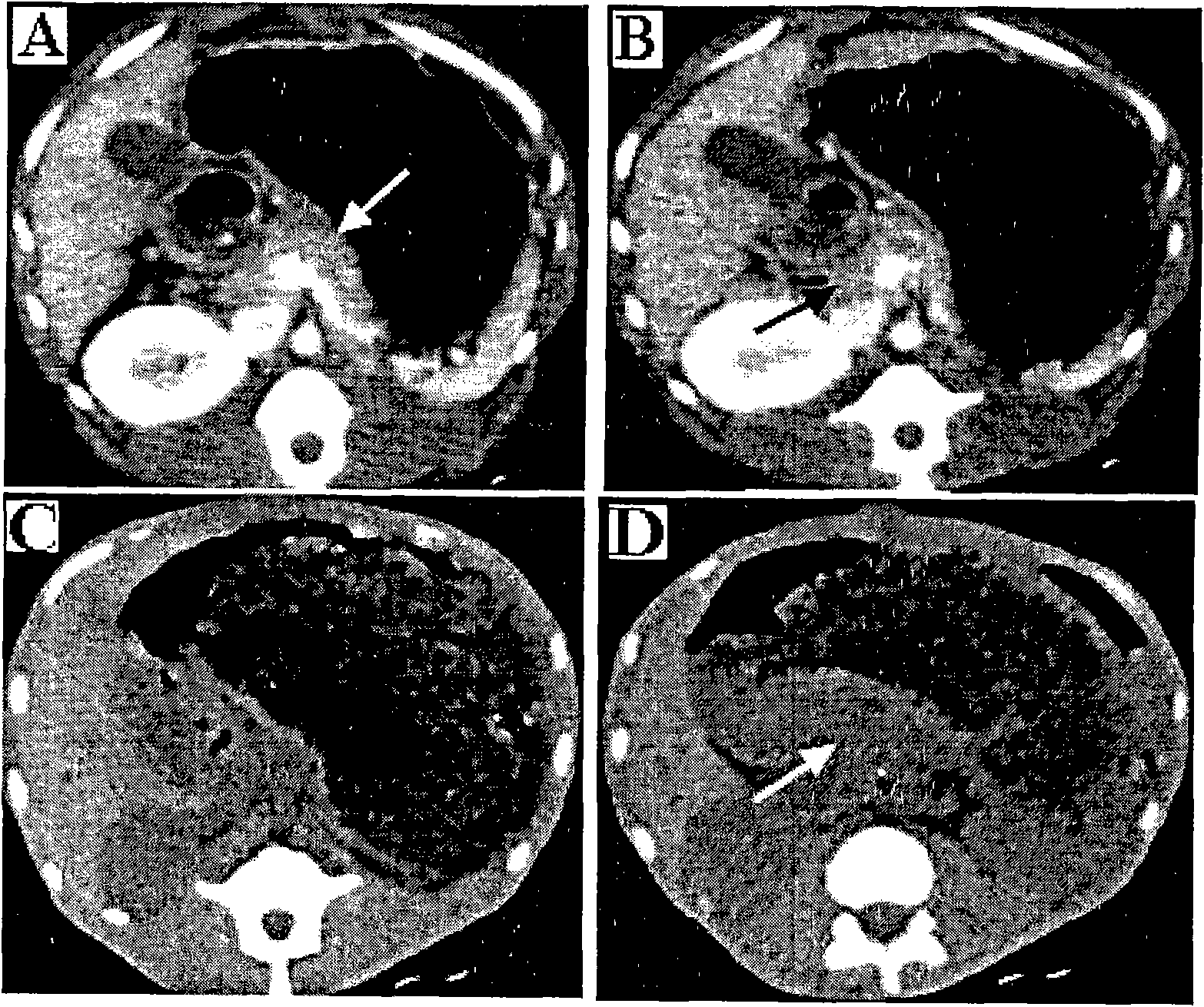 Method for preparing diabetic animal model