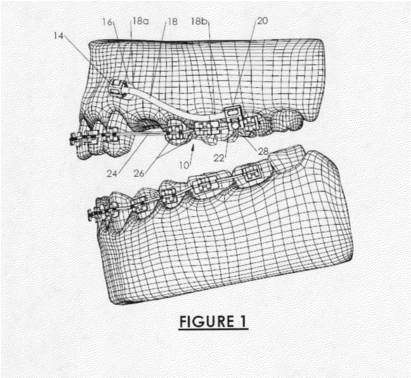 Orthodontic Appliance Anchoring Method and Apparatus