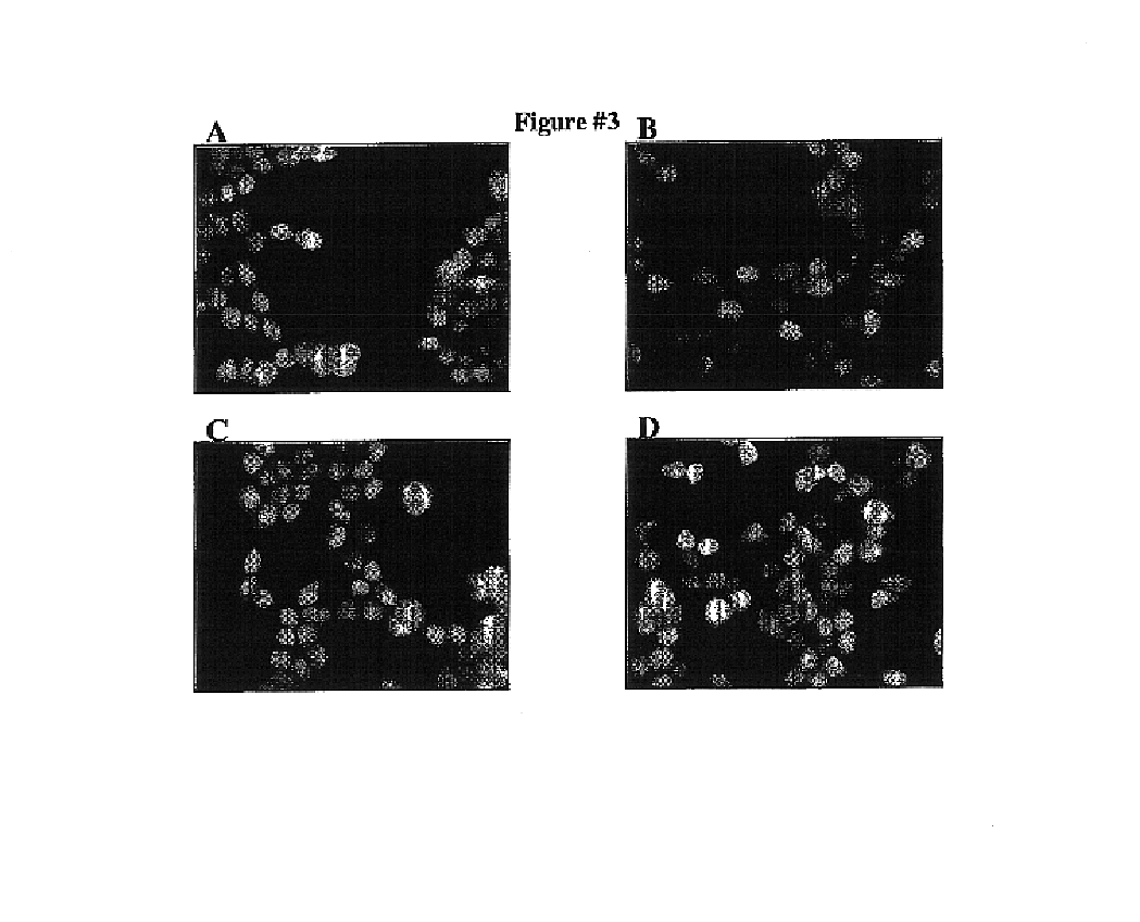 Protein fragment complementation assay (PCA) for the detection of protein-protein, protein-small molecule and protein nucleic acid interactions based on the E. coli TEM-1 beta-Lactamase