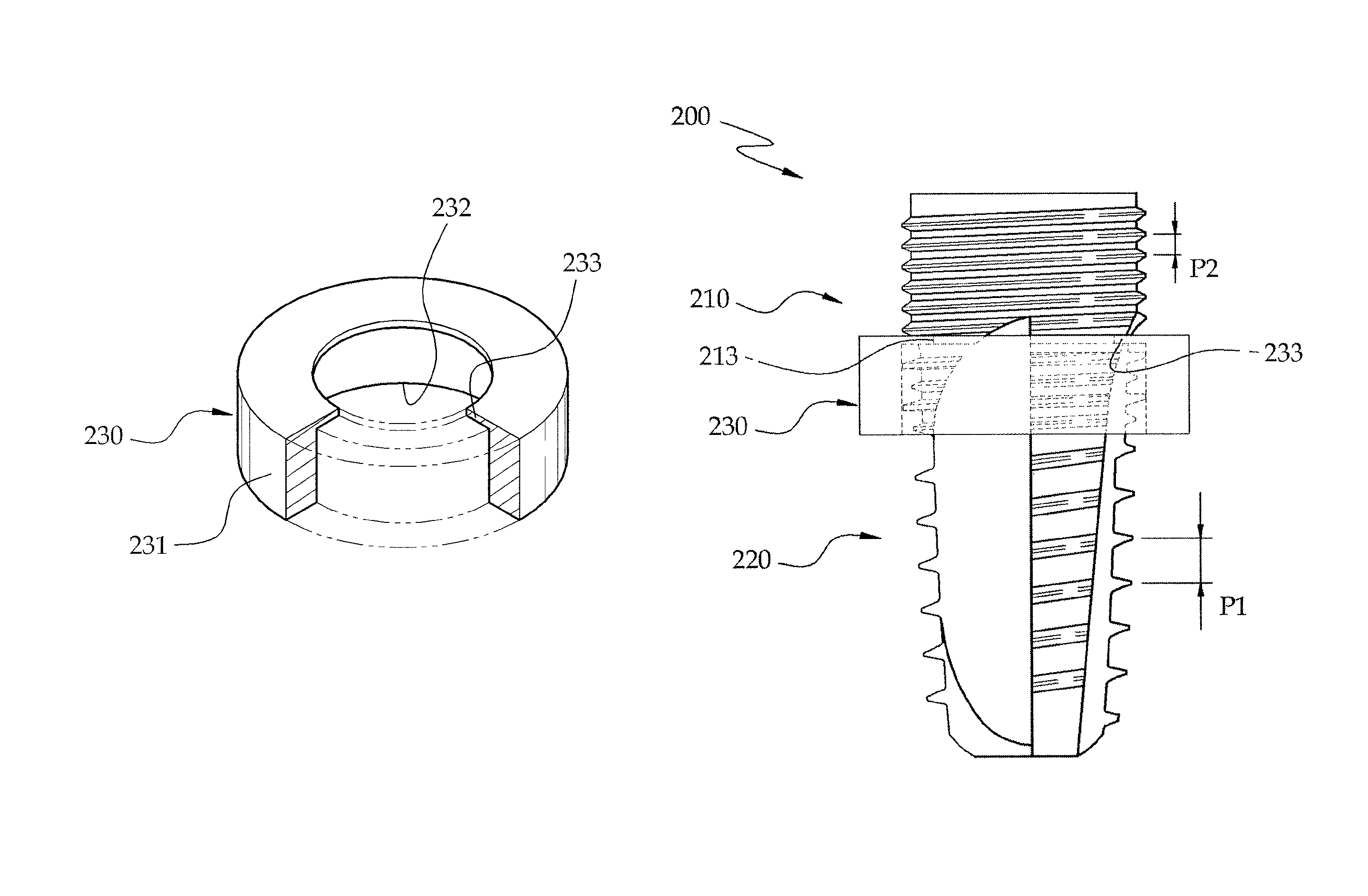 Method of manufacturing a fixture of a dental implant