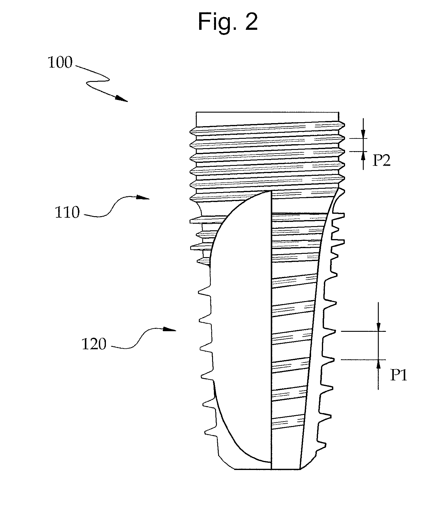 Method of manufacturing a fixture of a dental implant