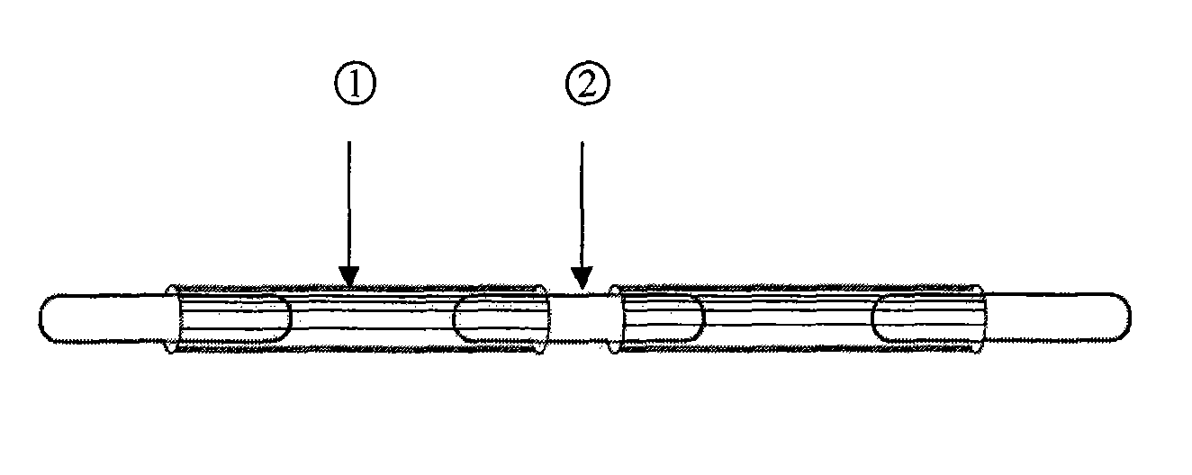 Radioactive particle chain connected by controlled degradable magnesium and magnesium alloy pipe