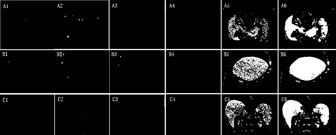 A Method for Setting the Initial Pose of Liver Statistical Shape Model