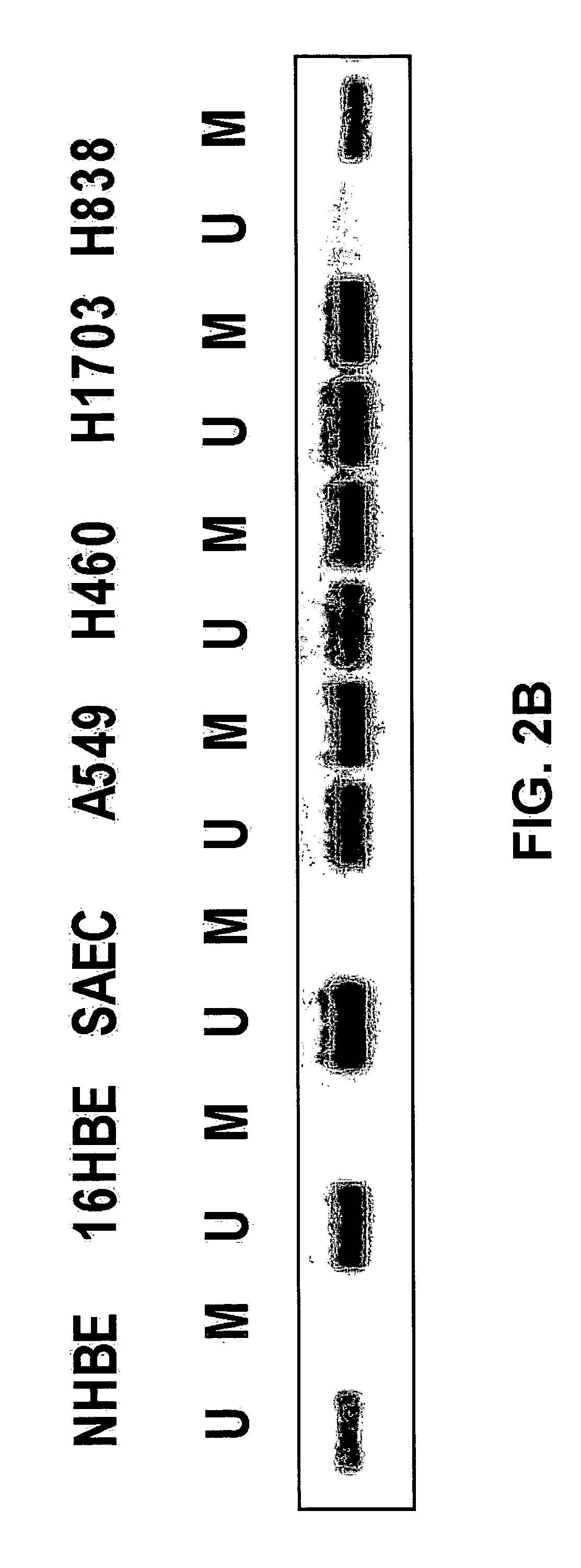 Methods for treating and diagnosing cancer with WNT inhibitory Factor-1 (WIF-1)