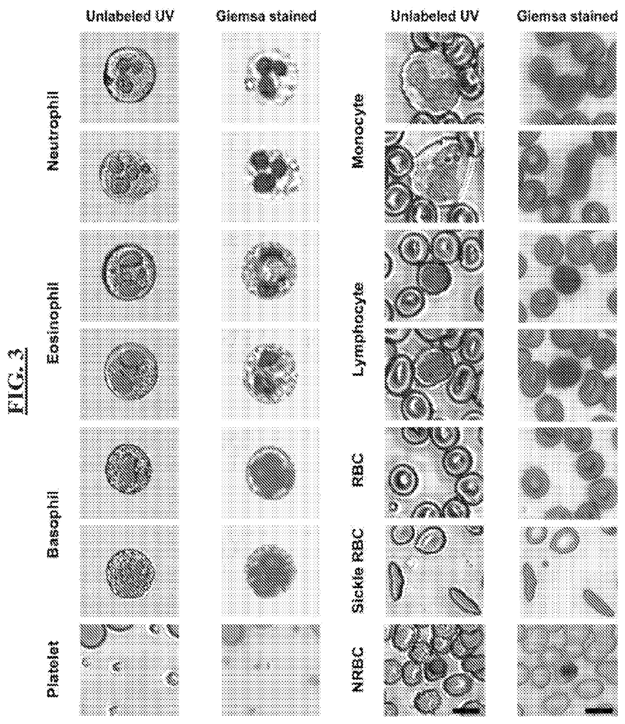 Label-Free Hematology and Pathology Analysis Using Deep-Ultraviolet Microscopy