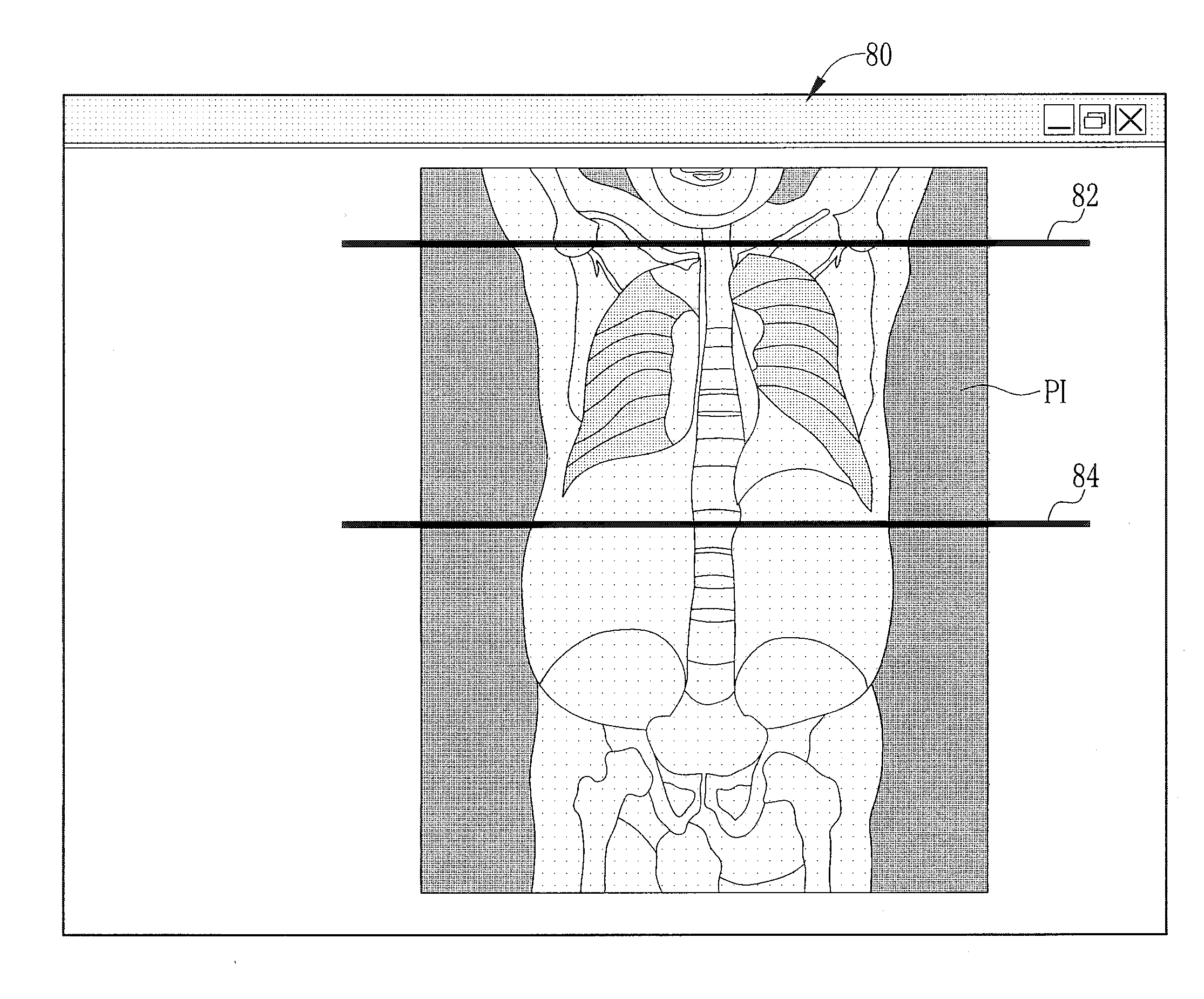 Imaging method and modality for medical application