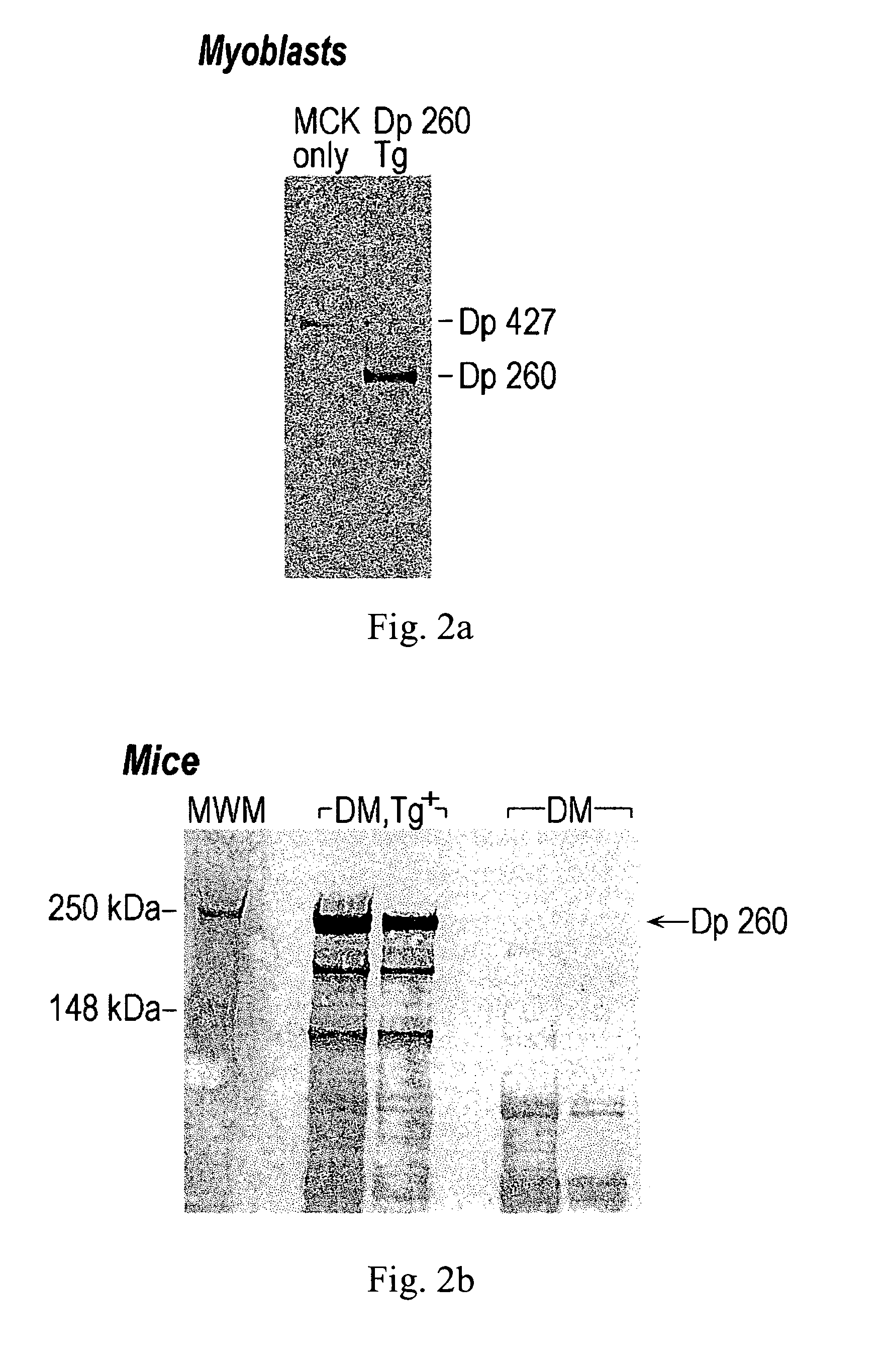 Retinal dystrophin transgene and methods of use thereof
