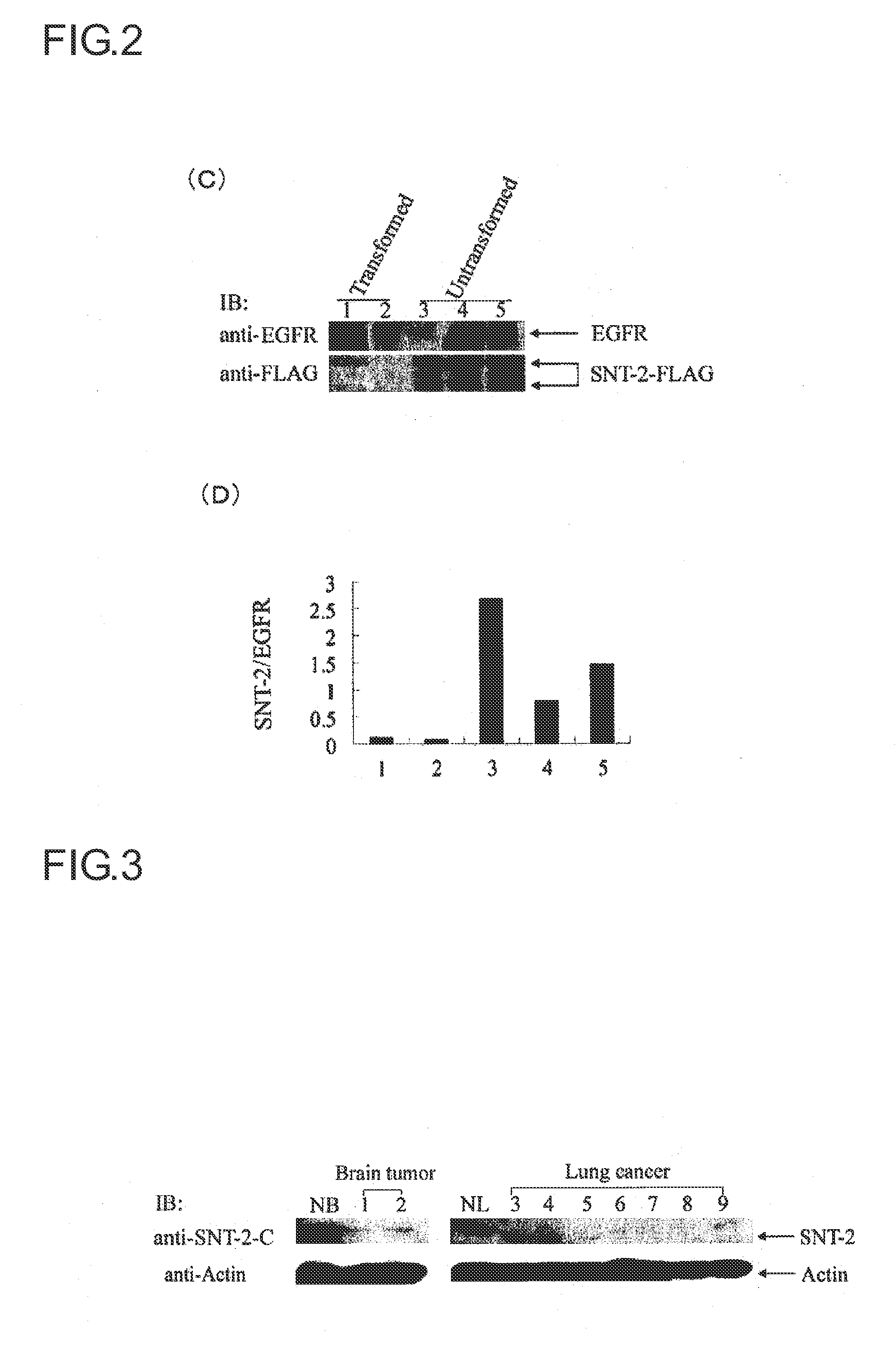 Method for inhibiting signal transduction, signal transduction inhibitor to be used therein and use thereof