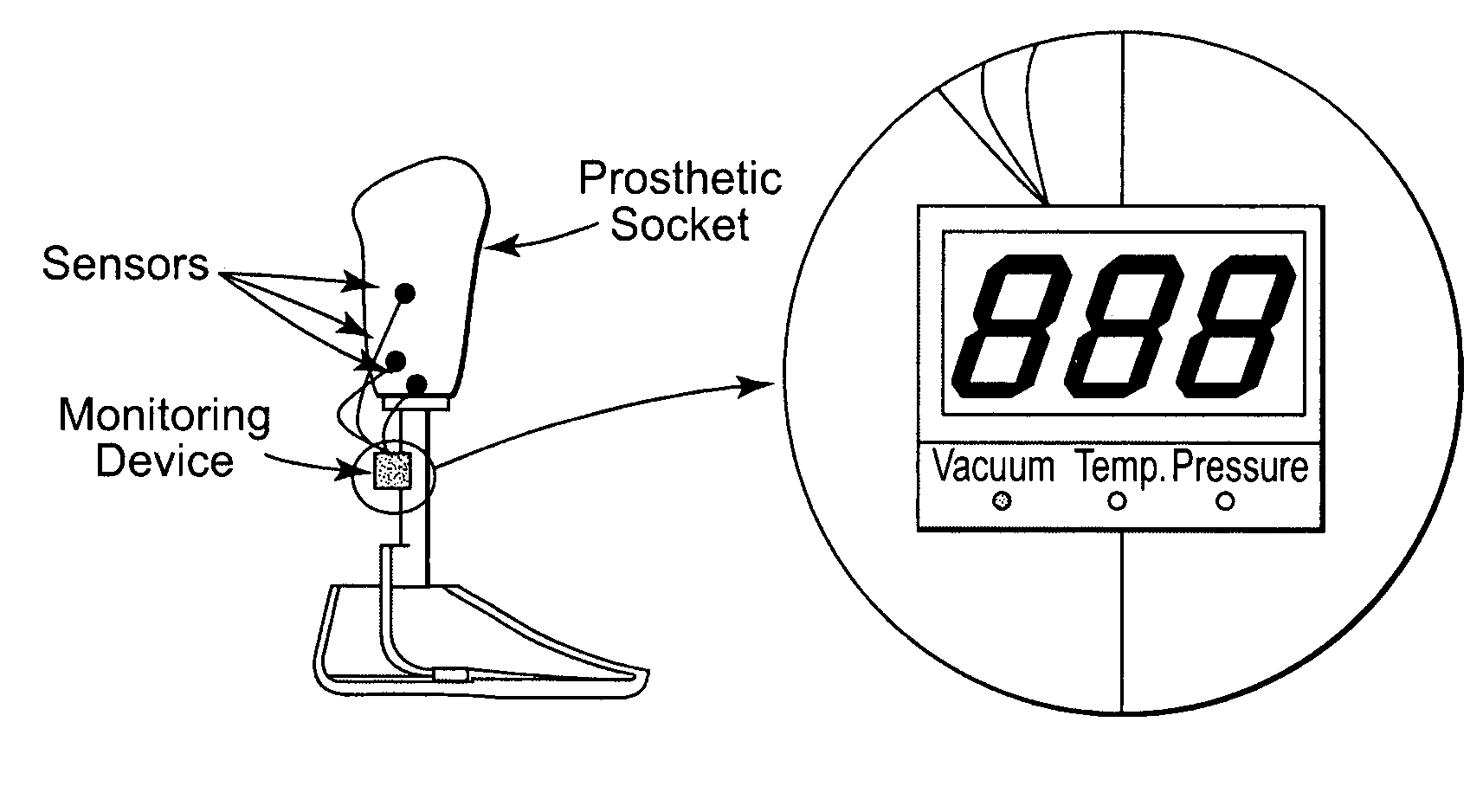 Pressure/temperature monitoring device for prosthetics