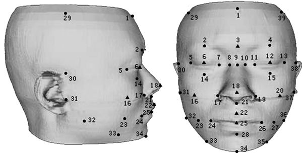 Zonal statistic model based facial reconstruction method