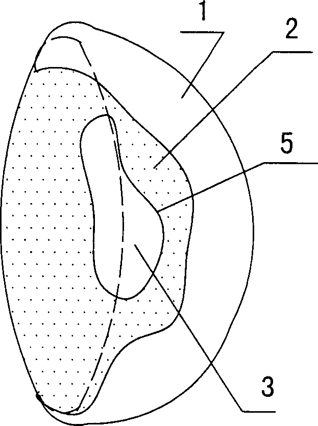 Mamma prosthesis containing air