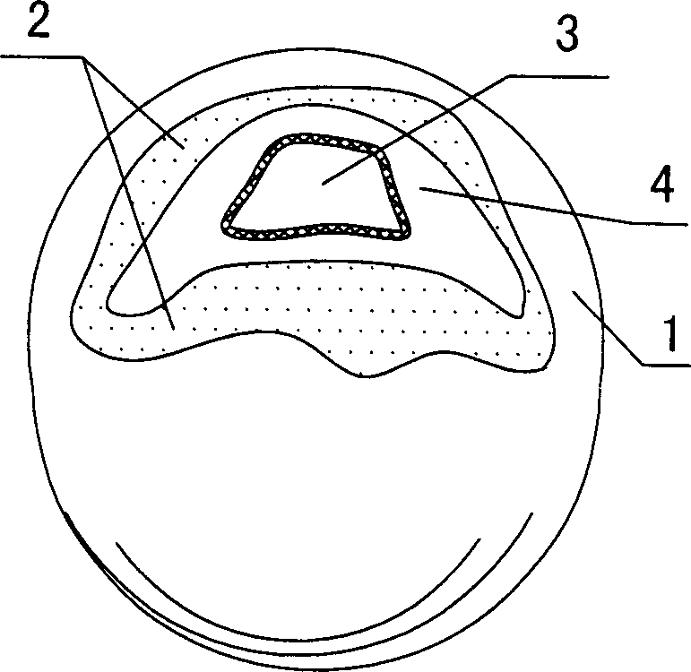 Mamma prosthesis containing air