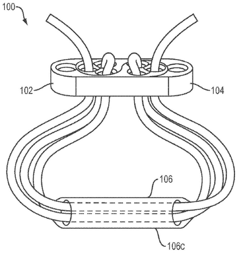 Methods and devices for tissue graft fixation