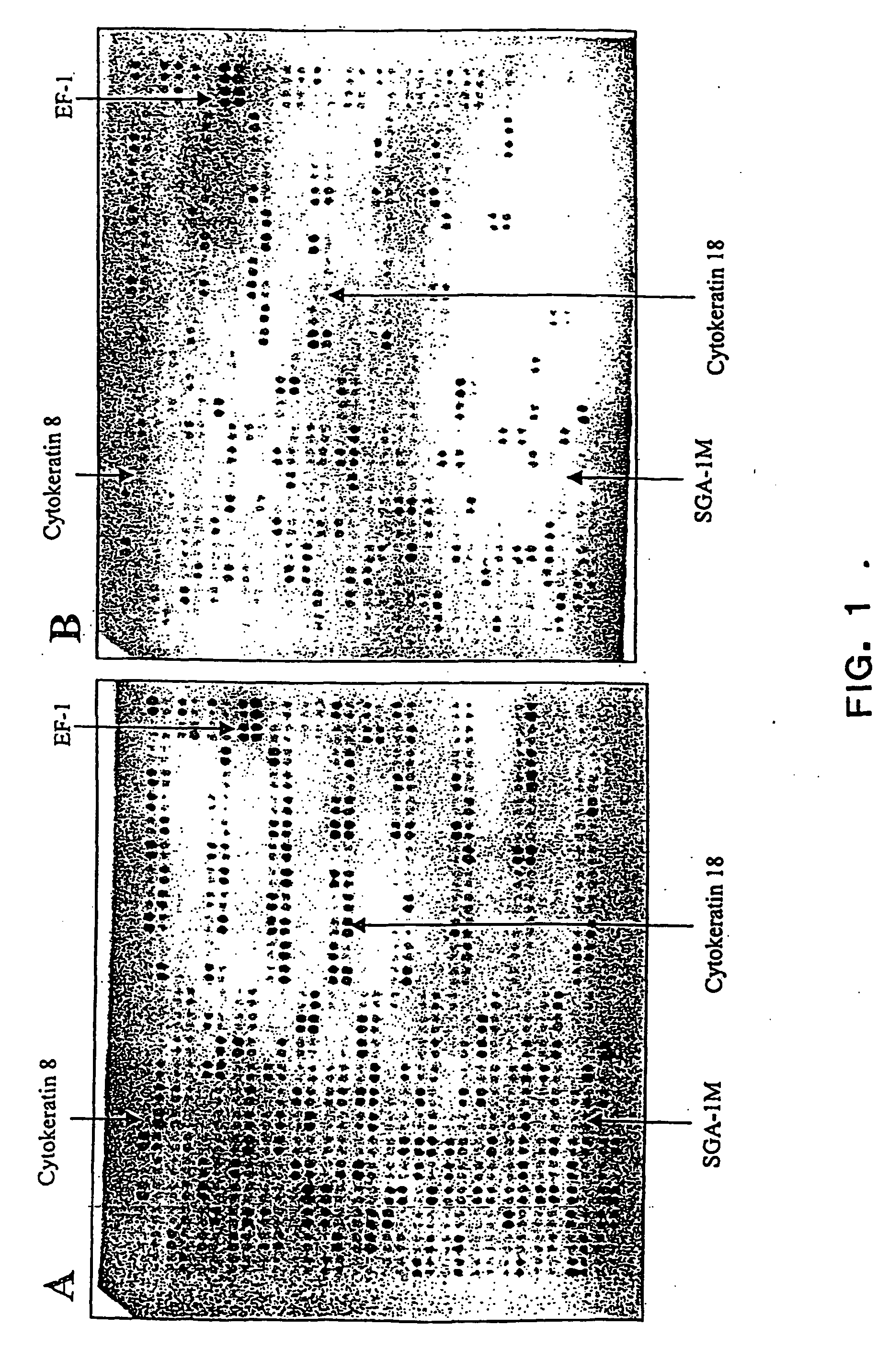 Sga-1m, a cancer associated antigen, and uses thereof