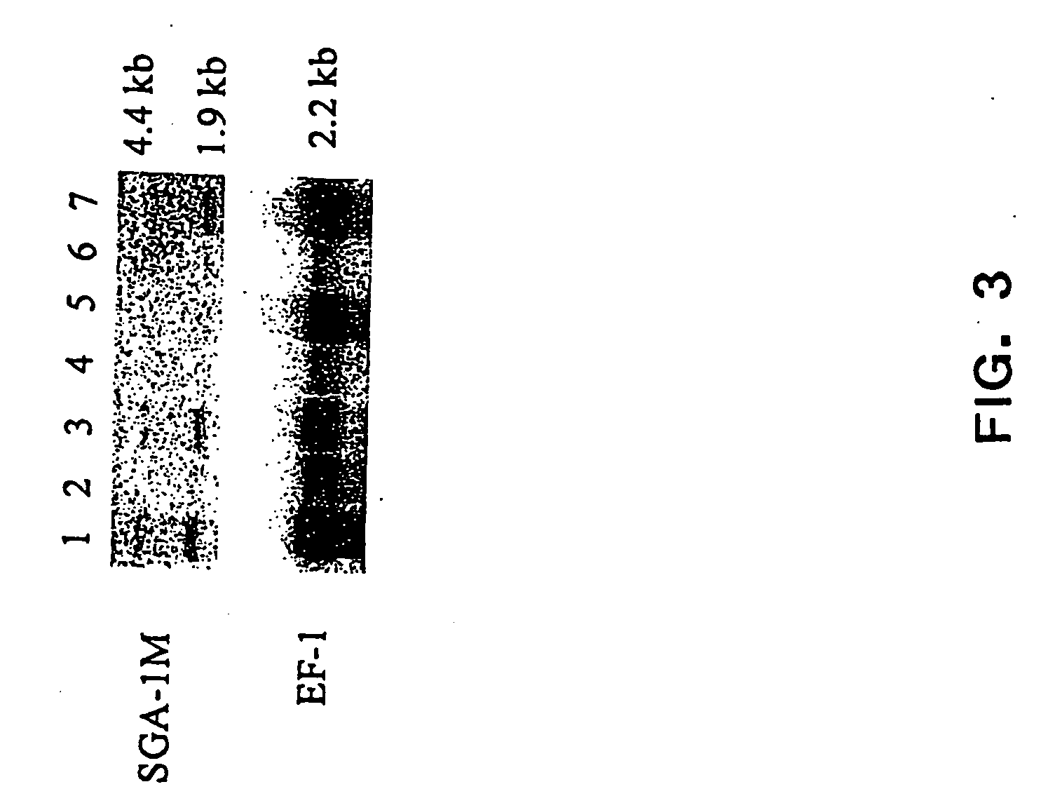 Sga-1m, a cancer associated antigen, and uses thereof