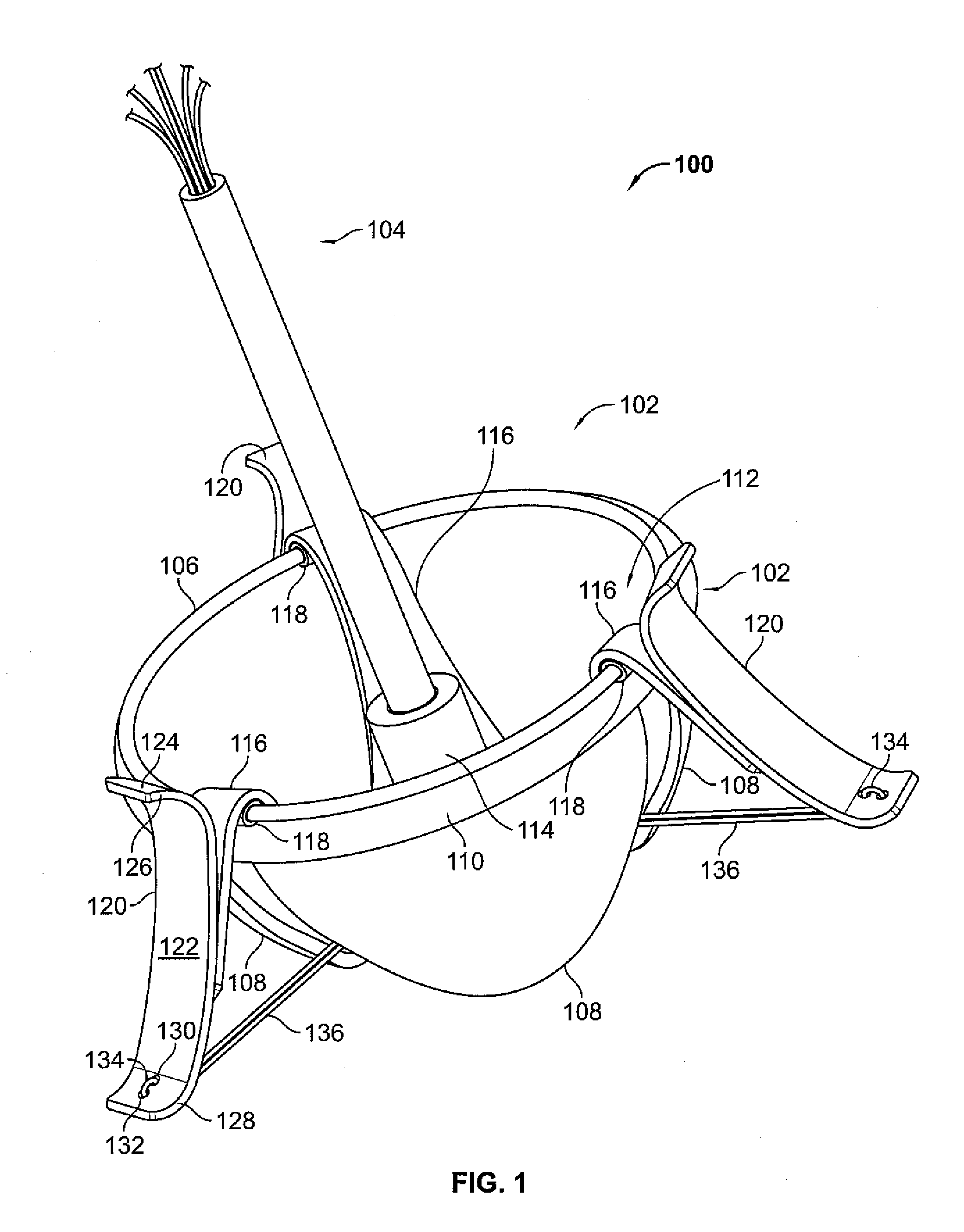 Systems and Methods For Placement of Valve Prosthesis System
