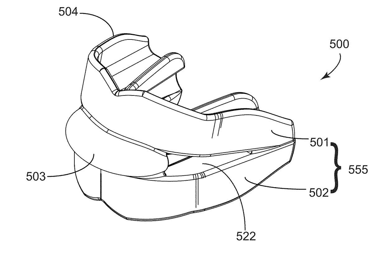 Dental Appliance