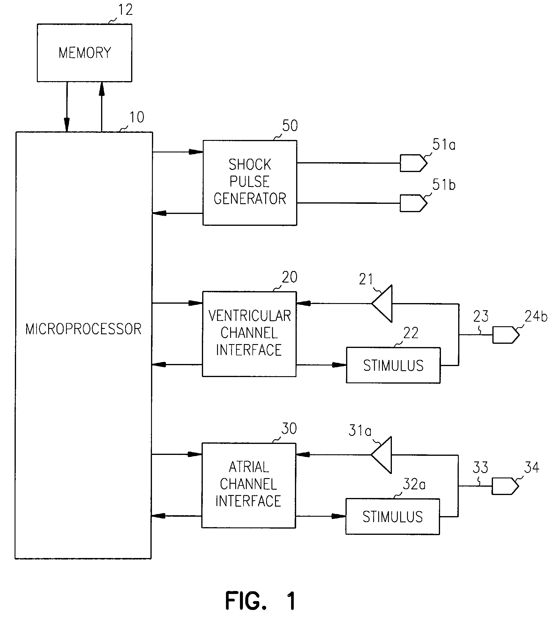 Method and apparatus for termination of cardiac tachyarrhythmias