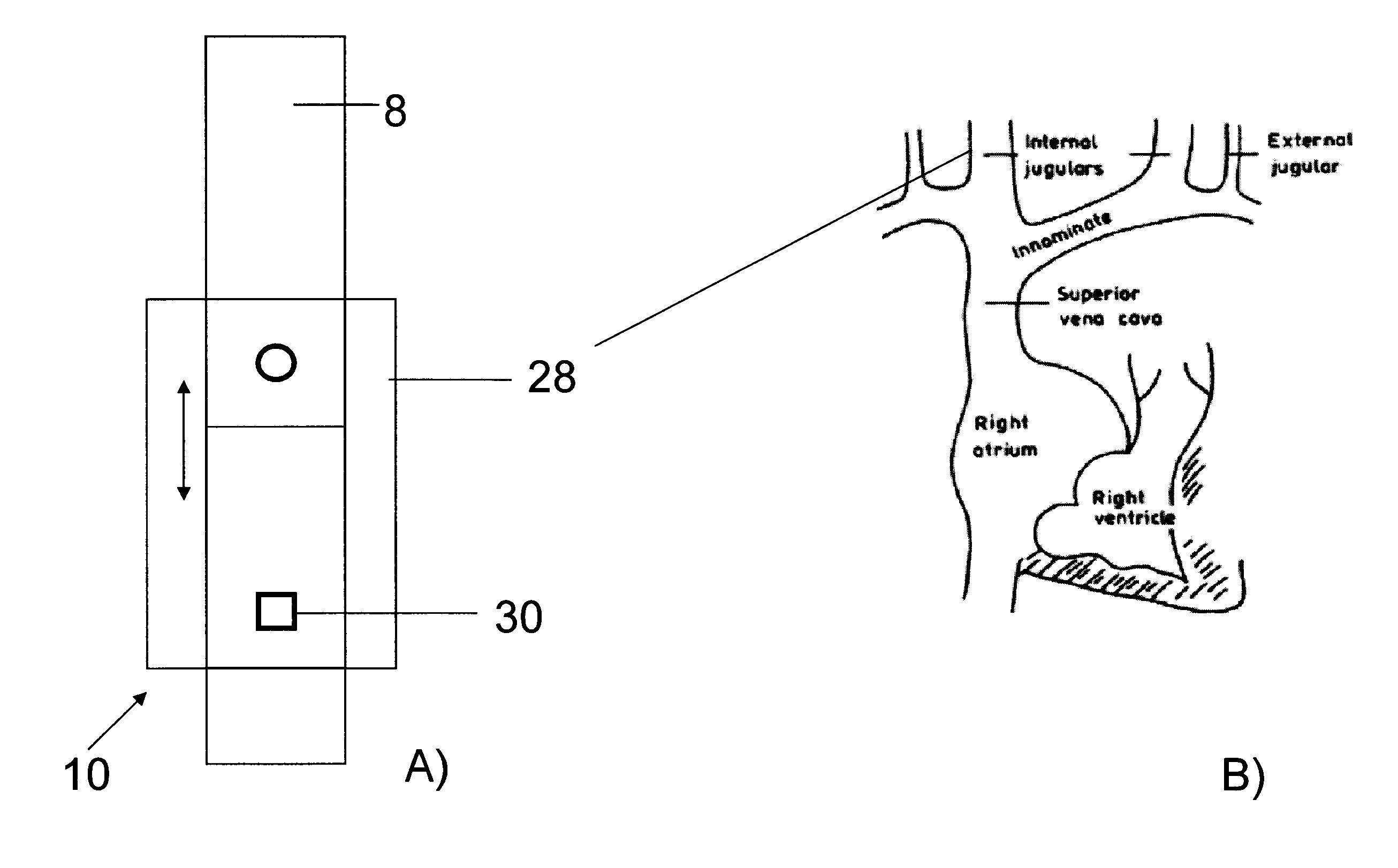 Method and device for measuring venous blood oxygenation