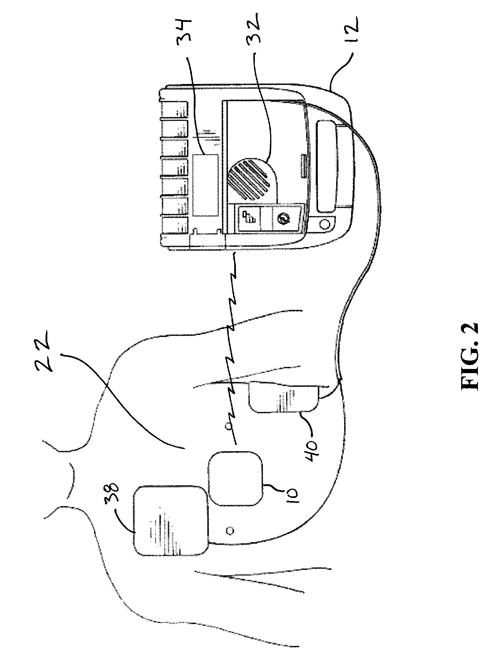 CPR feedback method and apparatus