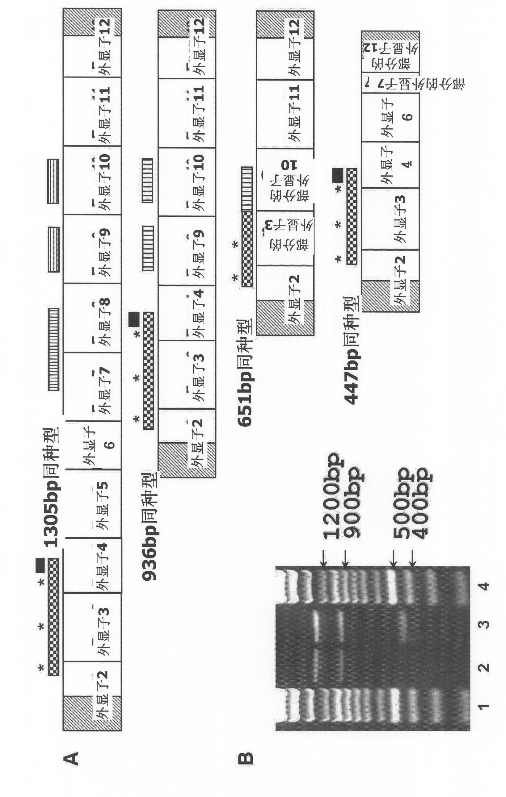 Rtef-1 variants and the use thereof for inhibition of angiogenesis