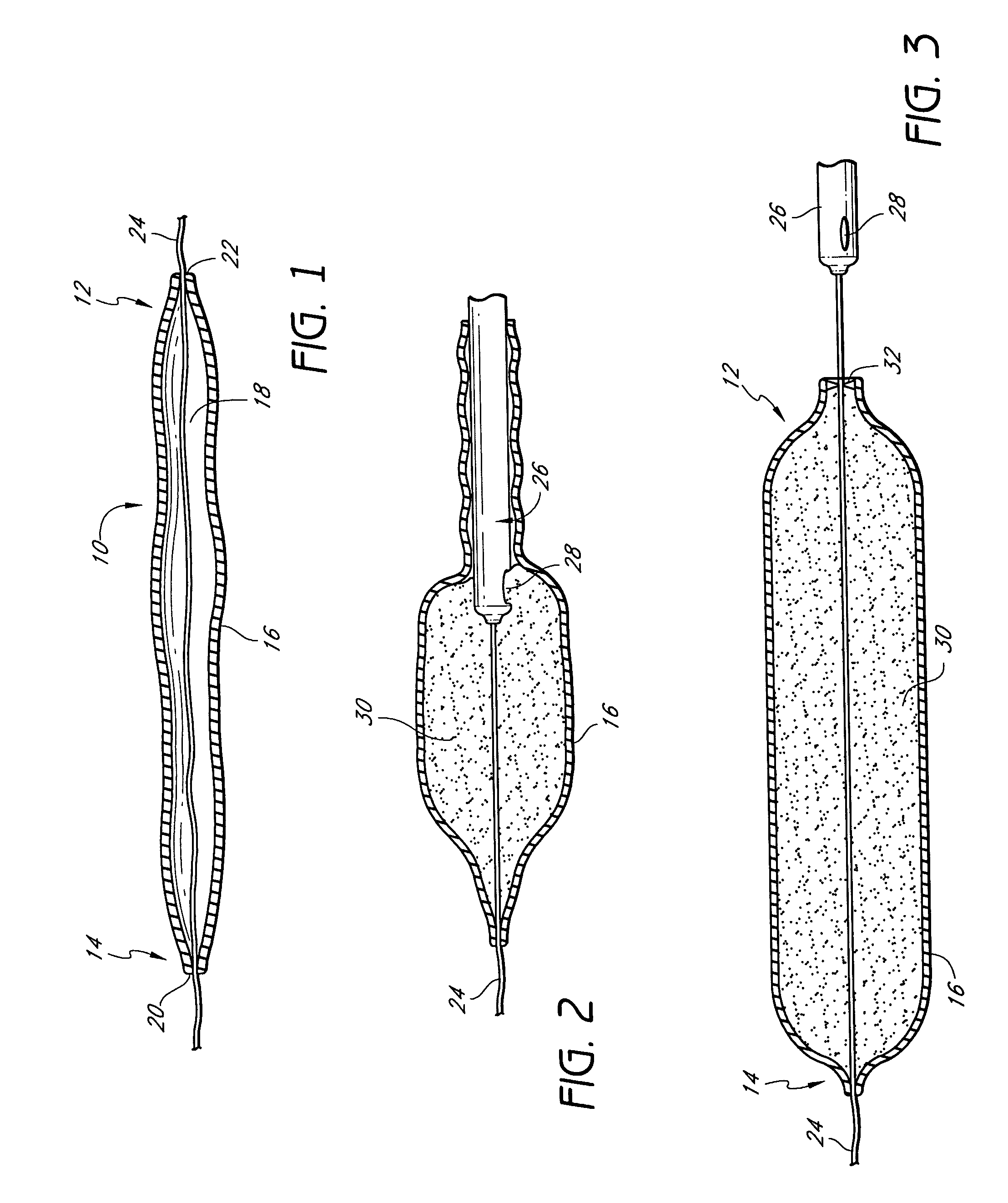 Transformable tissue bulking device