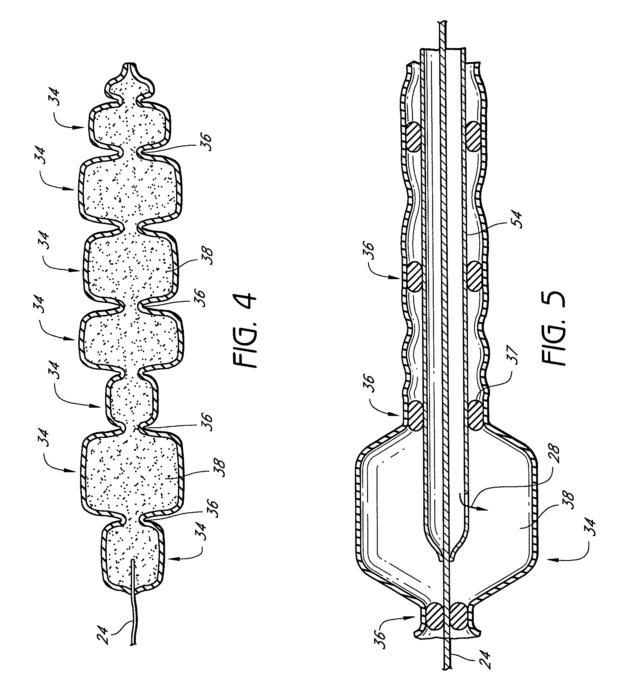 Transformable tissue bulking device