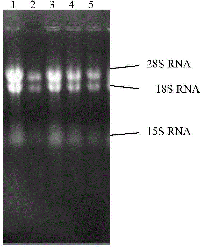 Cordyceps sinensis hirsutella-sinensis malic dehydrogenase B, encoding gene and application of two