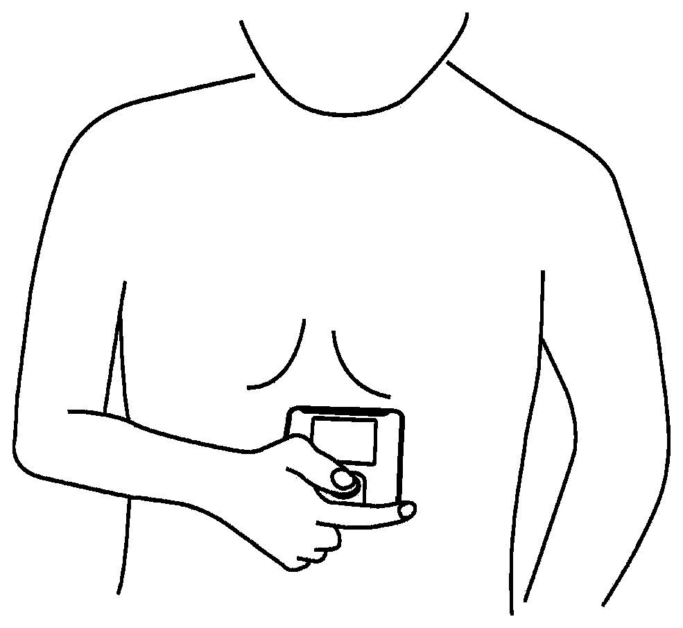 Neck-worn ECG monitoring device