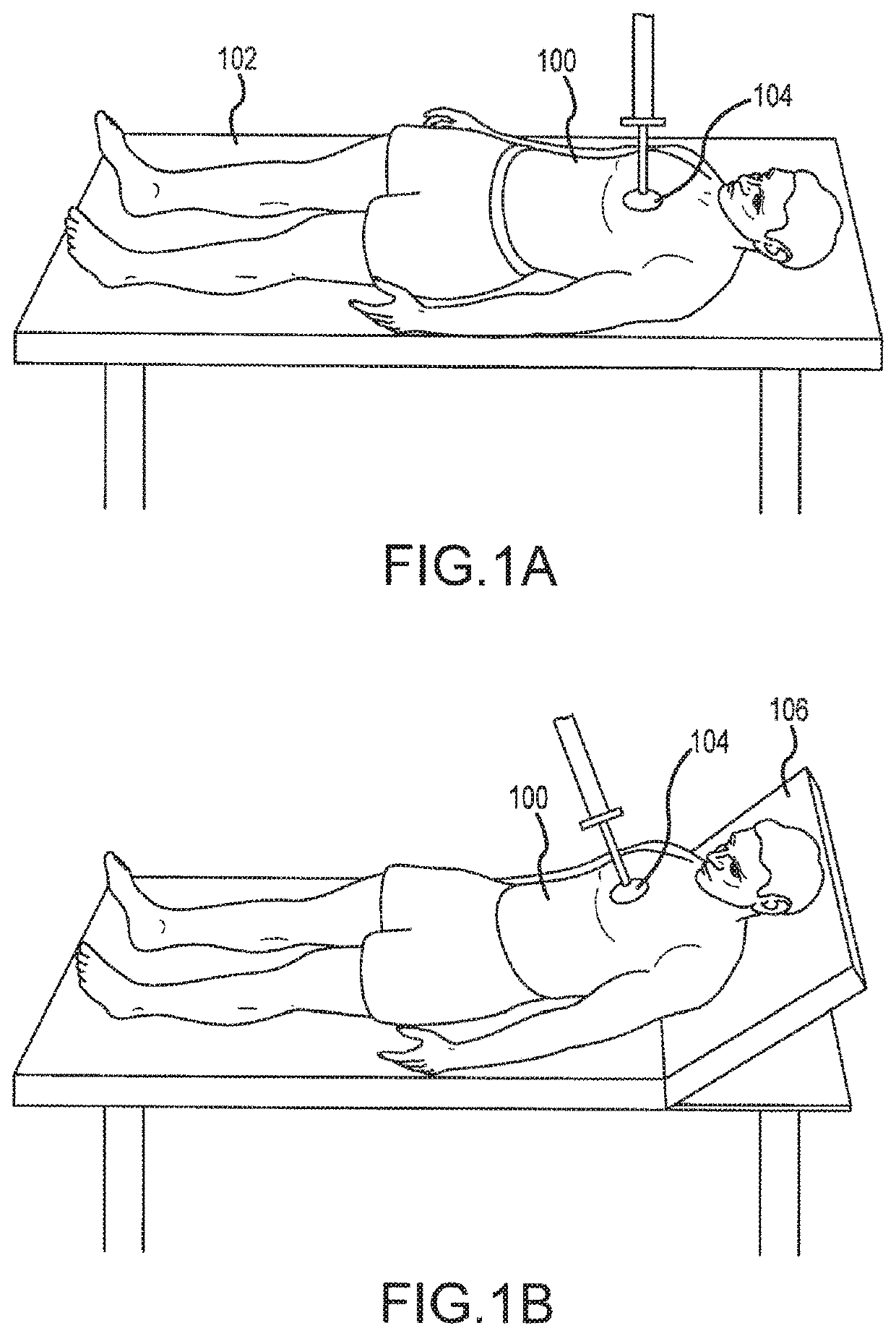 Systems and methods for improved post-resuscitation recovery