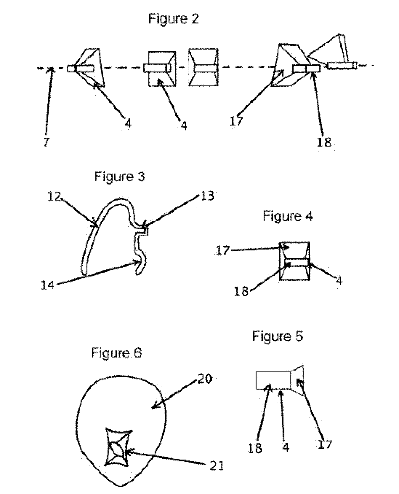 Removable lingual-vestibular dental alignment device and method for the production thereof