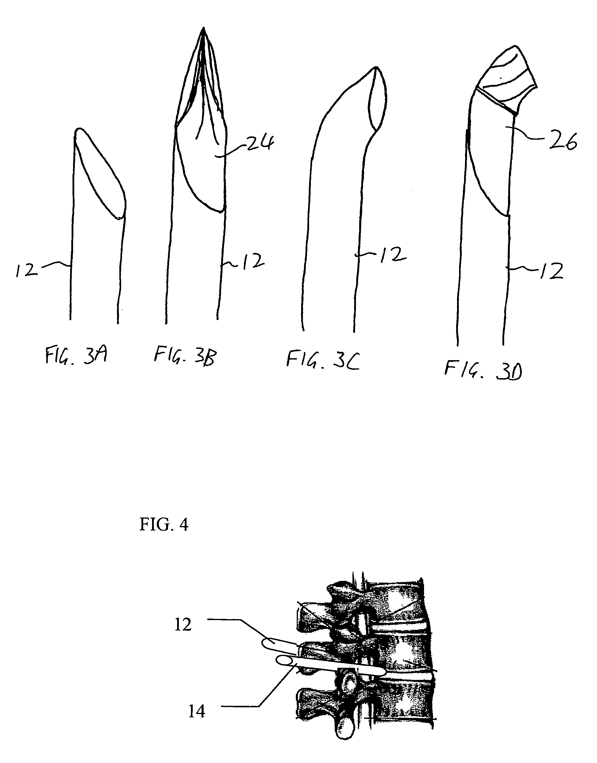 Spinal surgery system and method
