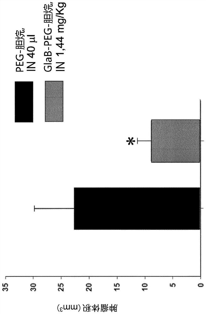 Compounds for use in the treatment of brain diseases