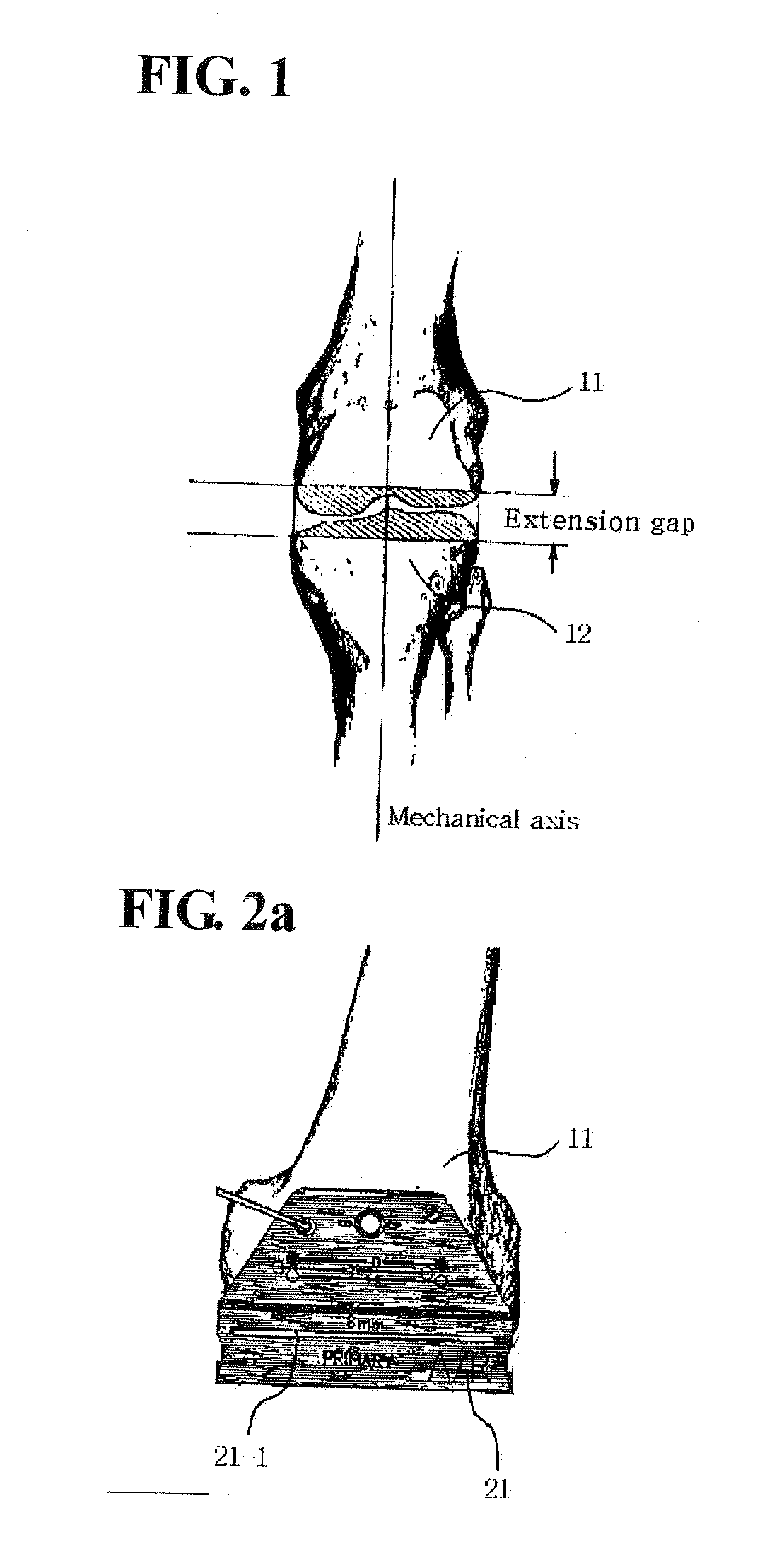 Alignment and connection device of femur cutter and tibia cutter and method of knee arthroplasty using the same