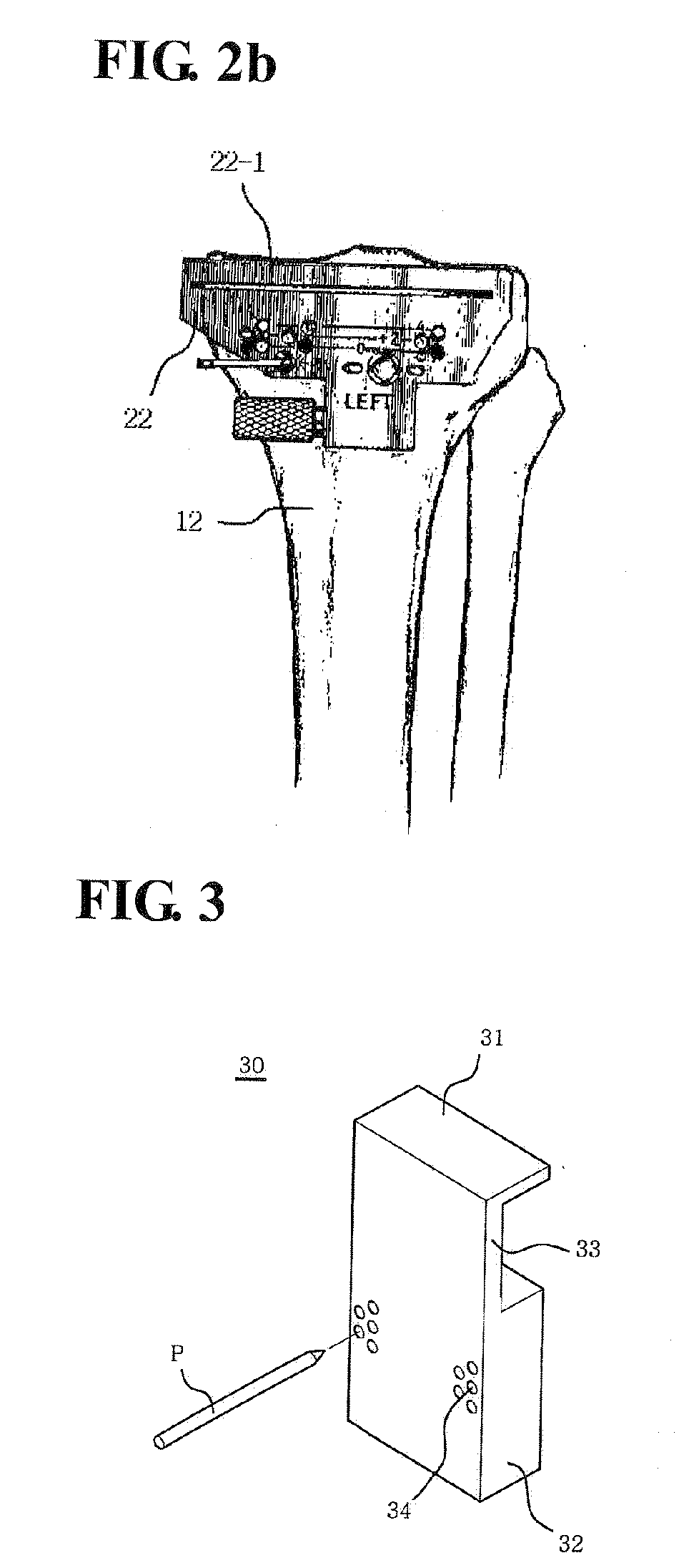 Alignment and connection device of femur cutter and tibia cutter and method of knee arthroplasty using the same