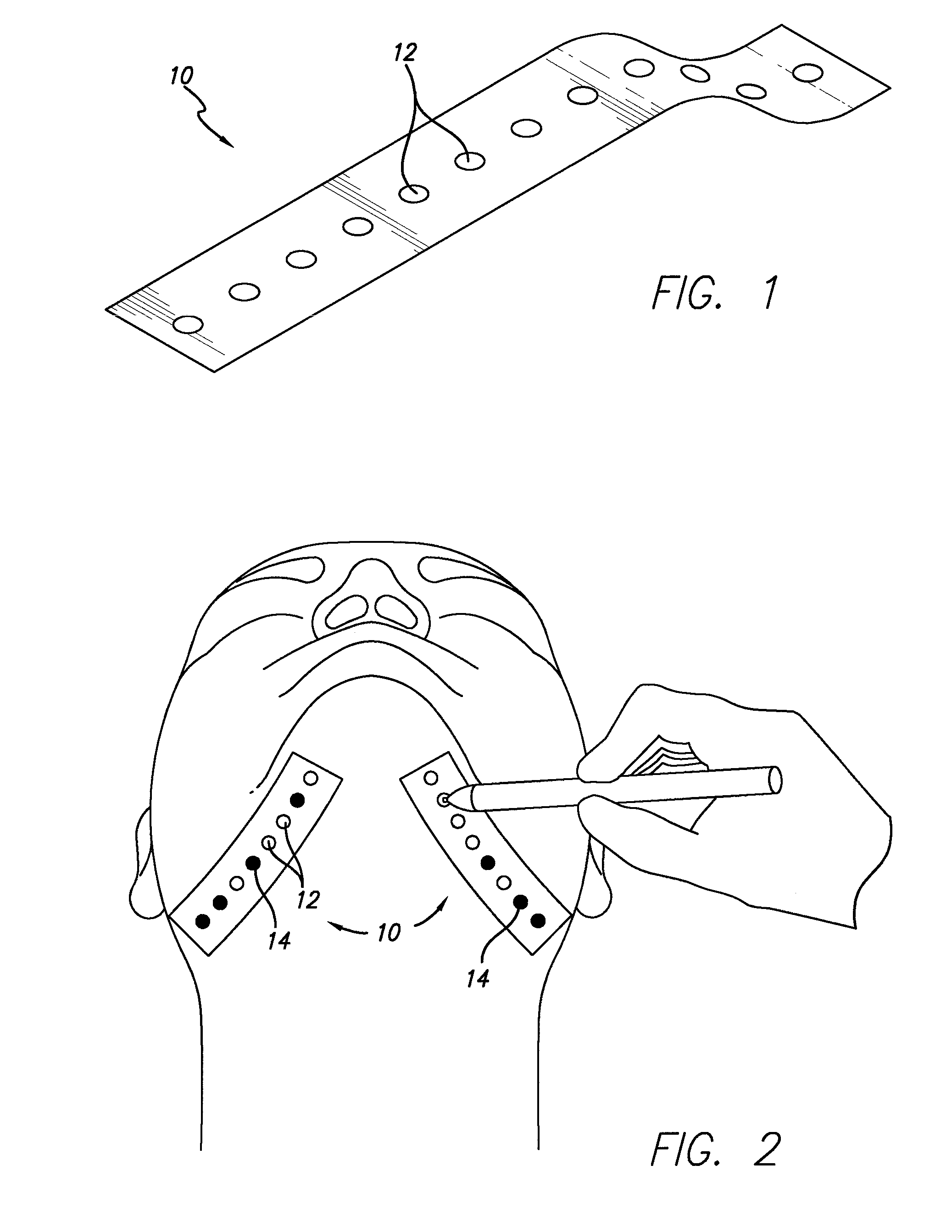 Suture and method for using same