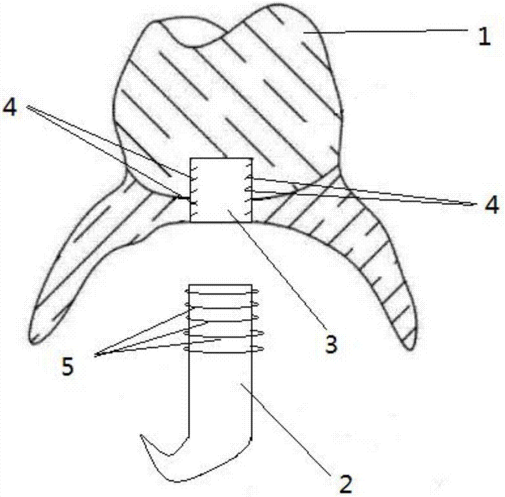 Zirconium dioxide all-ceramic tooth through 3D printing and preparation method thereof