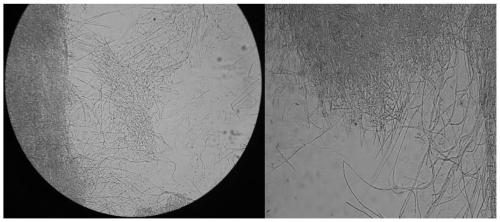 A strain of albicans and its application