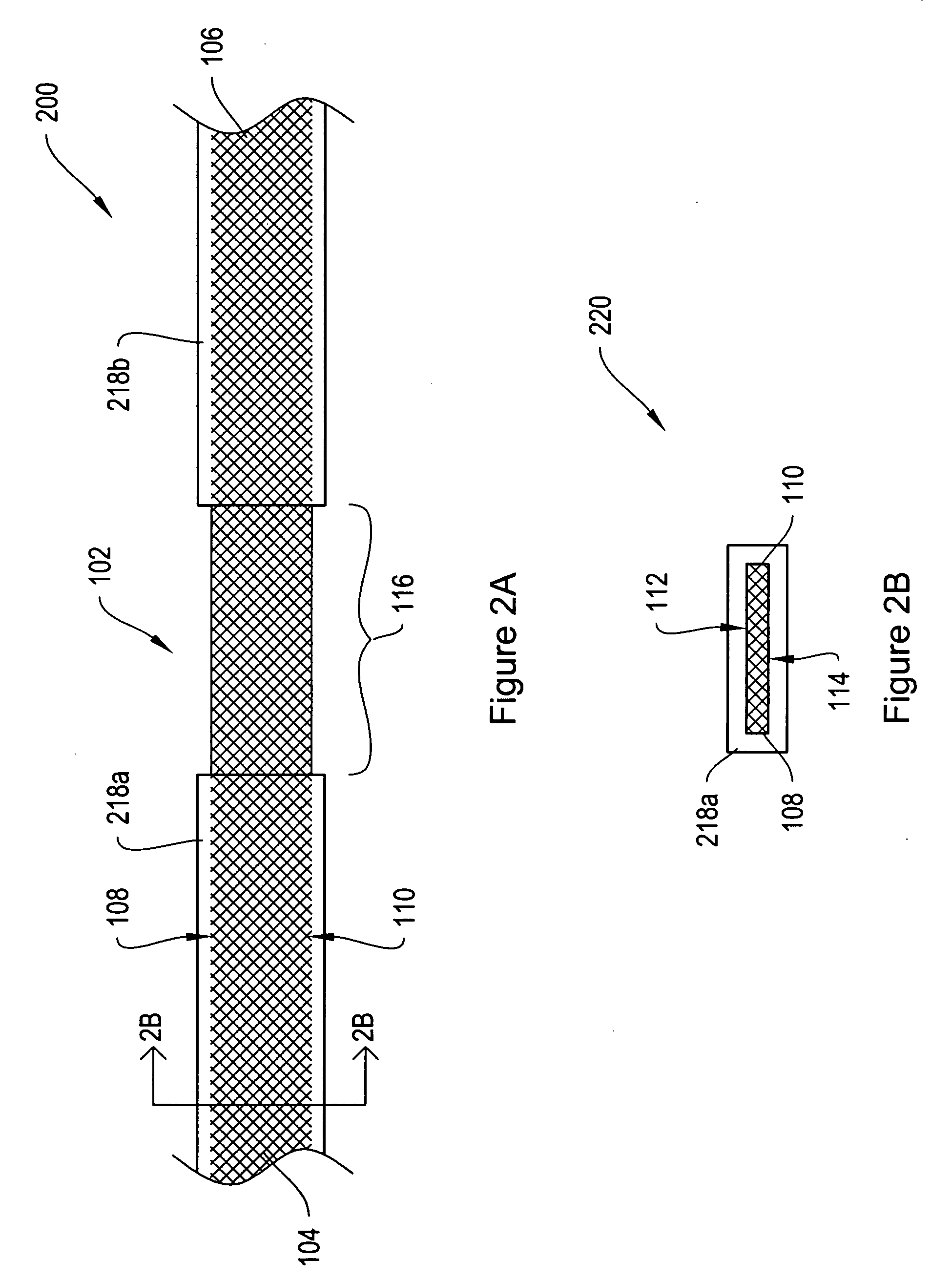 Dissolvable protective treatment for an implantable supportive sling