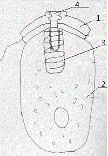 Dental implant gingival graft fixing guide plate, guide plate manufacturing method and fixing system