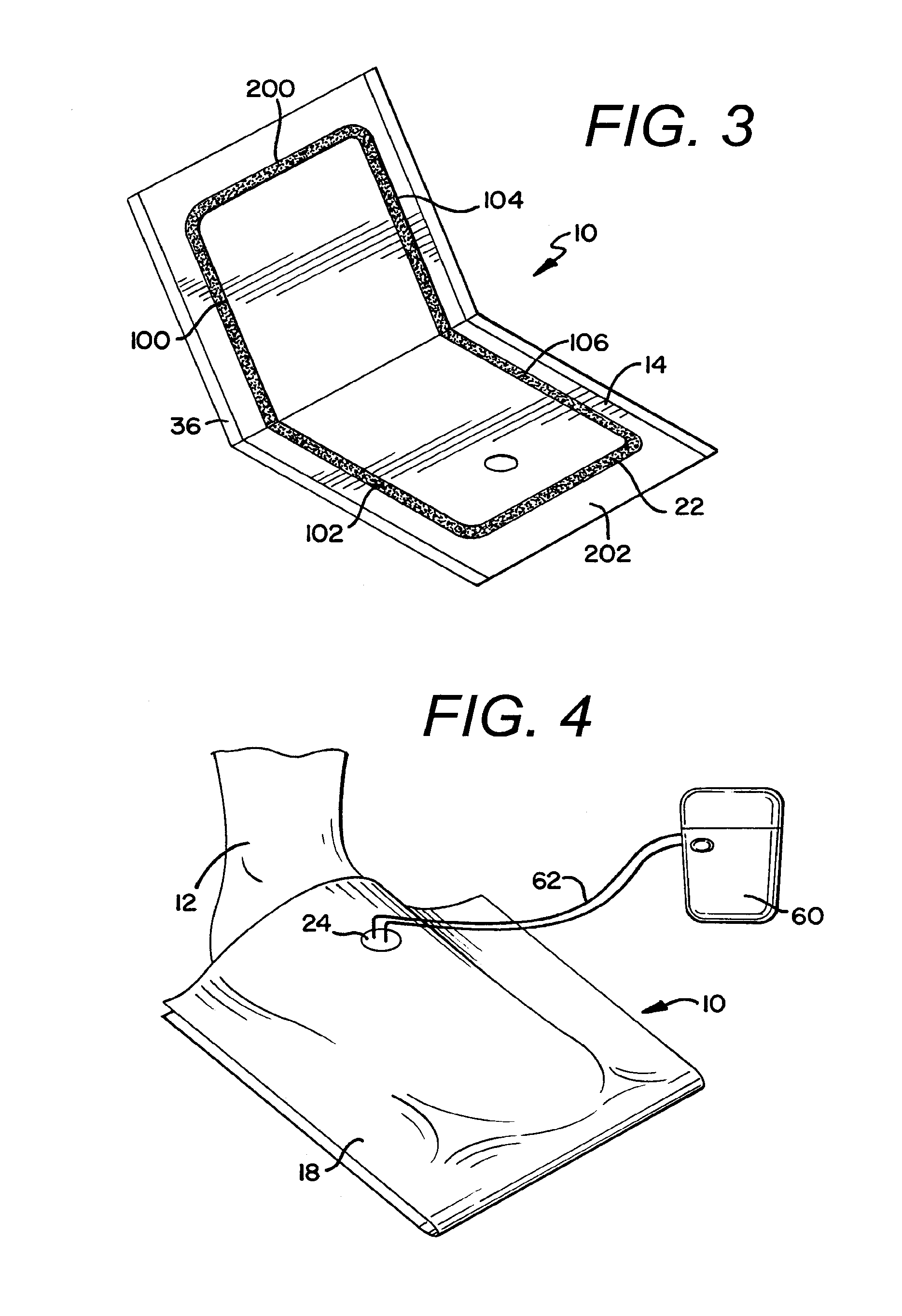 Negative Pressure Wound Therapy Device