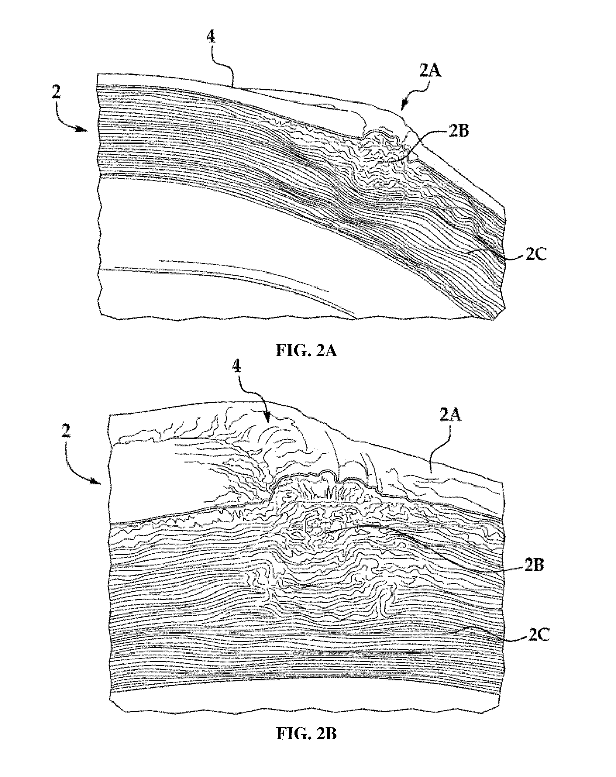 System and Method for Stabilizing Corneal Tissue After Treatment