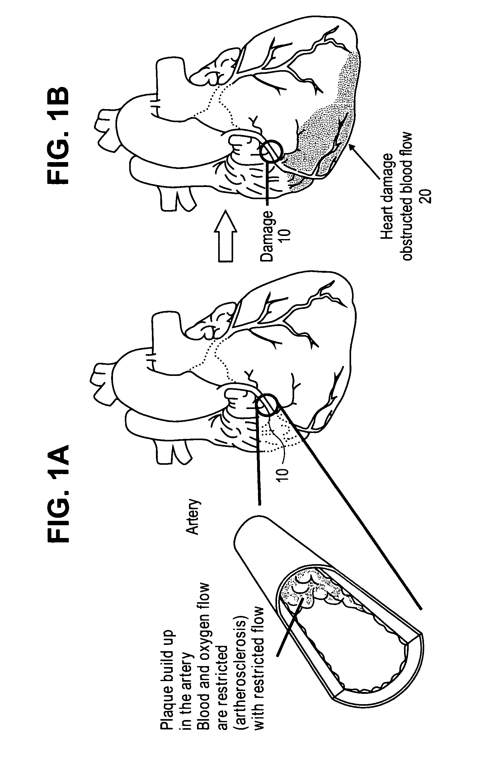 Methods and compositions for treating post-myocardial infarction damage