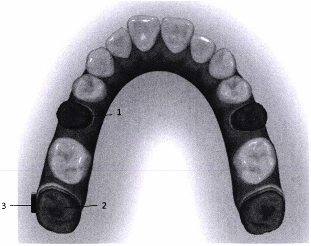 Bracket-free invisible orthodontic appliance produced based on tooth multi-position overlapping model and manufacturing method of bracket-free invisible orthodontic appliance