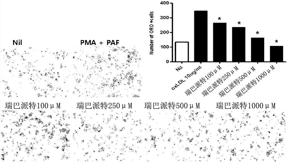 Composition comprising rebamipide as active ingredient for preventing or treating hyperlipemia and diseases associated therewith