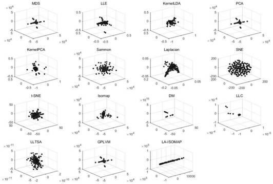 Clustering visualization method for epilepsy data dimension reduction based on salient point self-adaptive isometric mapping manifold