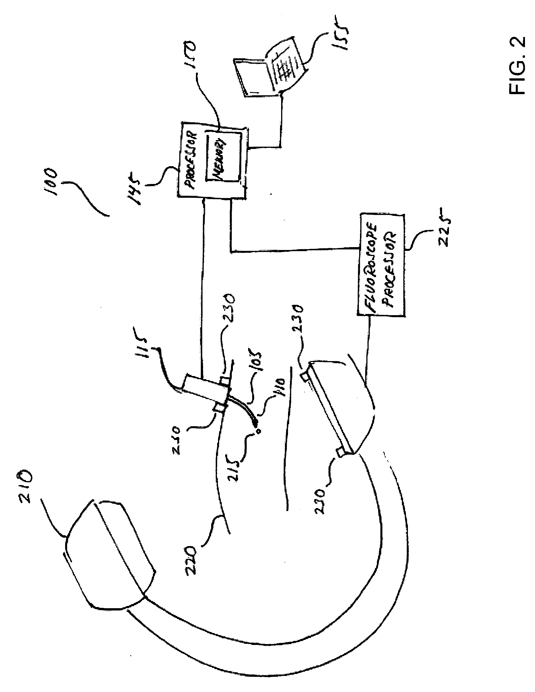 Distal bevel-tip needle control device and algorithm