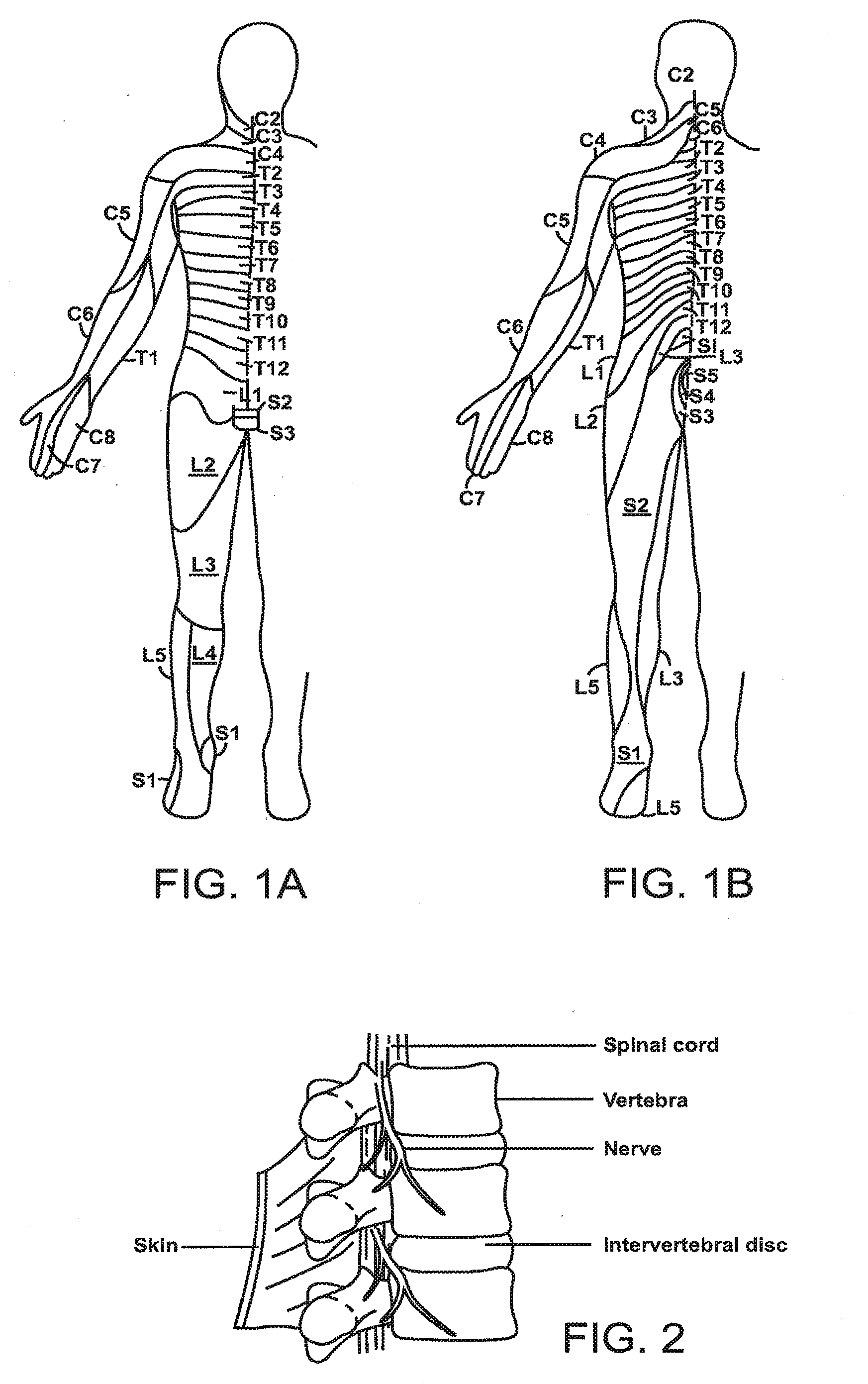 Systems and methods for neuromodulation for treatment of pain and other disorders associated with nerve conduction