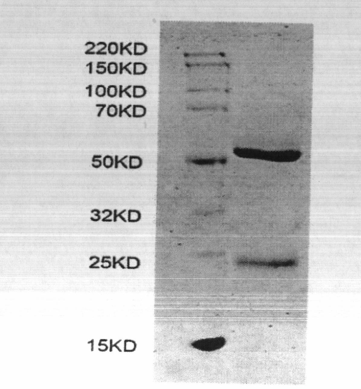 Preparation method and application of ractopamine monoclonal antibody